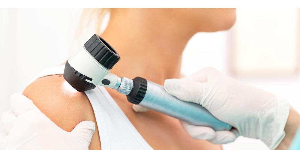 консультация дерматолога киев