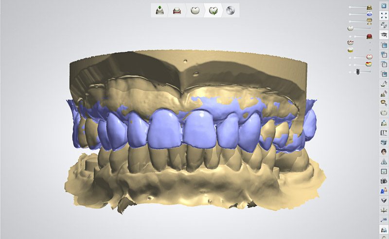 Кадекама. CAD/cam моделировка. Cam/CAD моделирование протезов. CAD/cam моделирование exocad. Моделировка в КАД Кам.